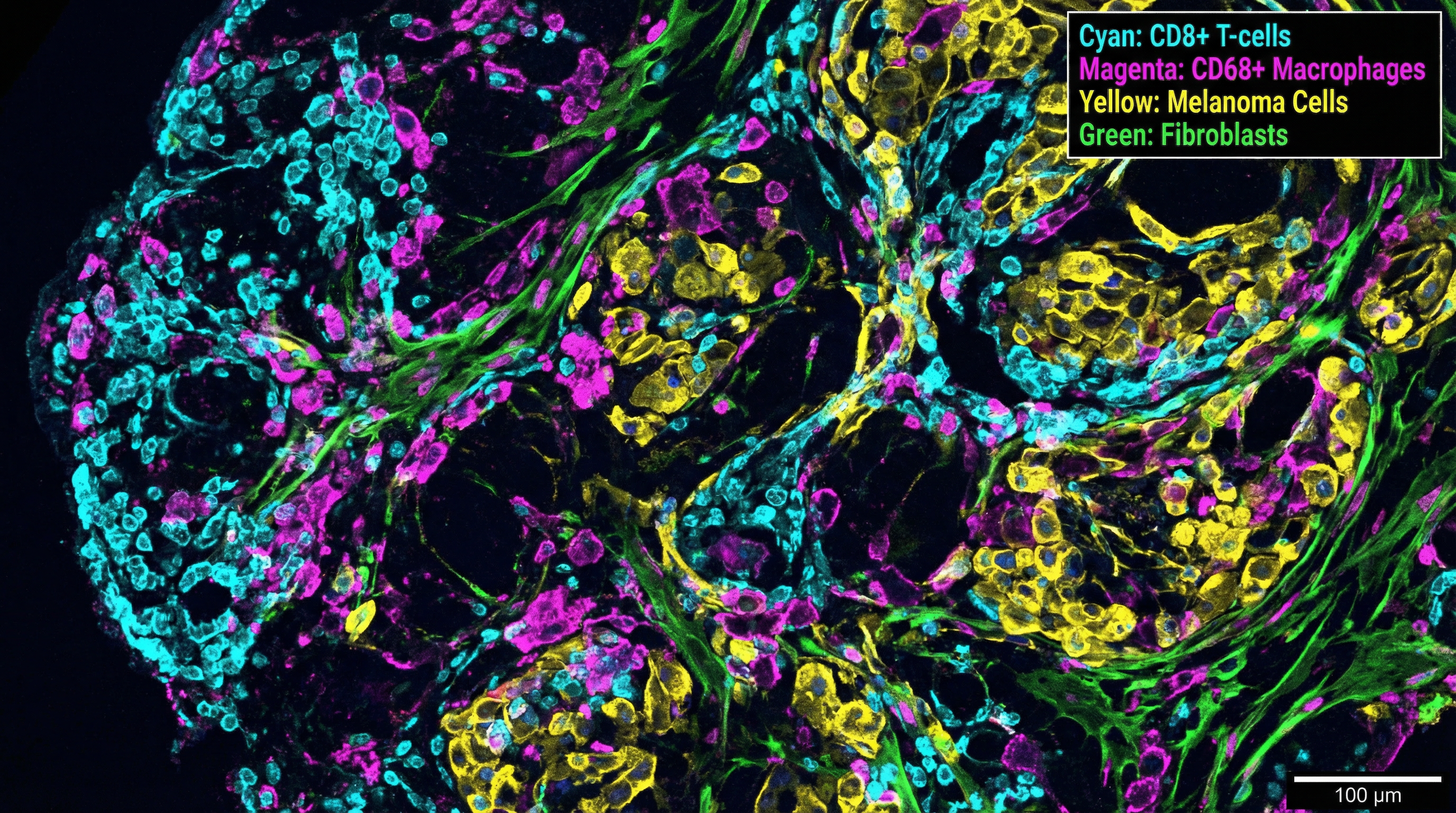 Multiplex immunofluorescence spatial biology tumor microenvironment visualization